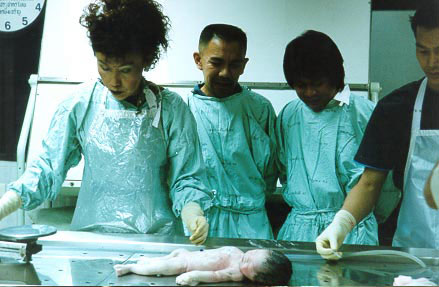 fetus lying on table top