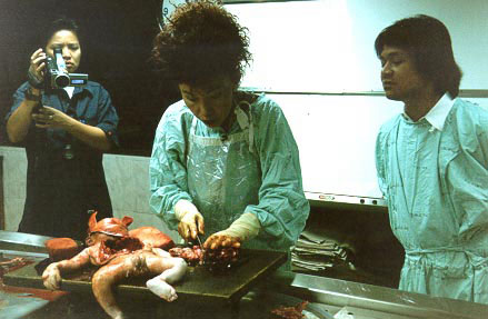 Butchering the dead fetus