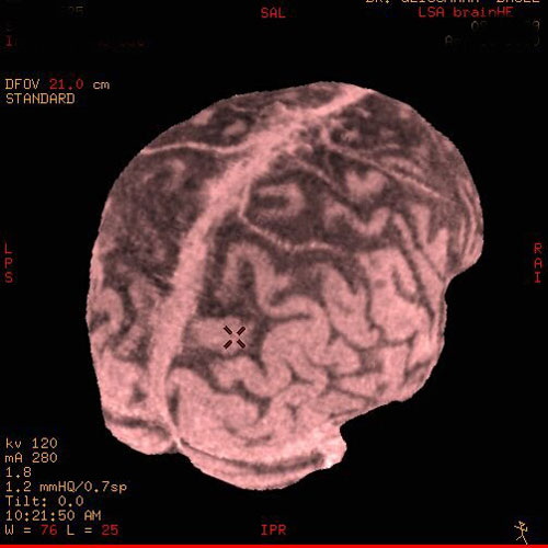 brain scan